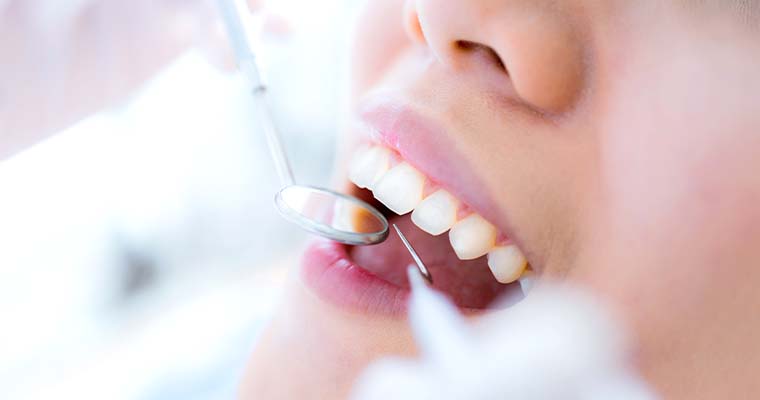 Treatment To Keep Your Own Teeth